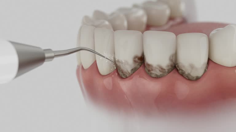 Reliable Dental Implants contractor in Sheldon, IA by Smile Center Dentistry